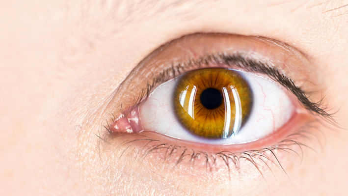 ইউভাইটিস