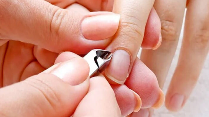 নখের পাশে চামড়া ওঠা