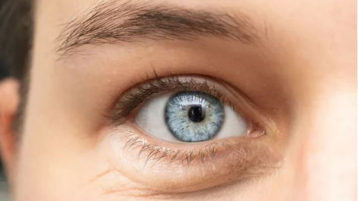 চোখের স্ট্রোক