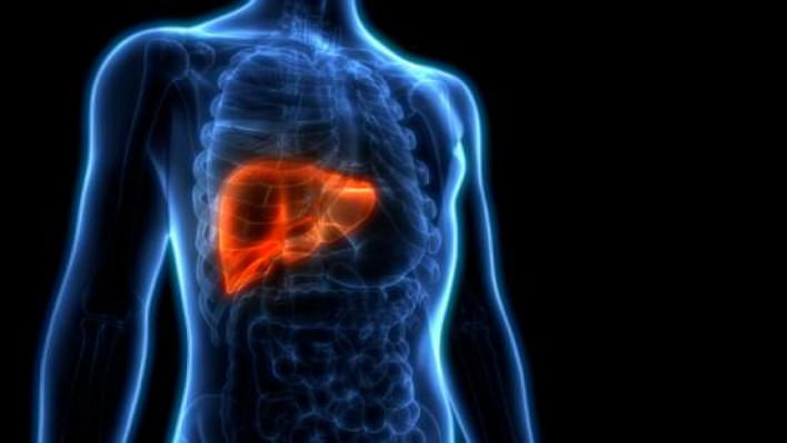 লিভার সিরোসিস