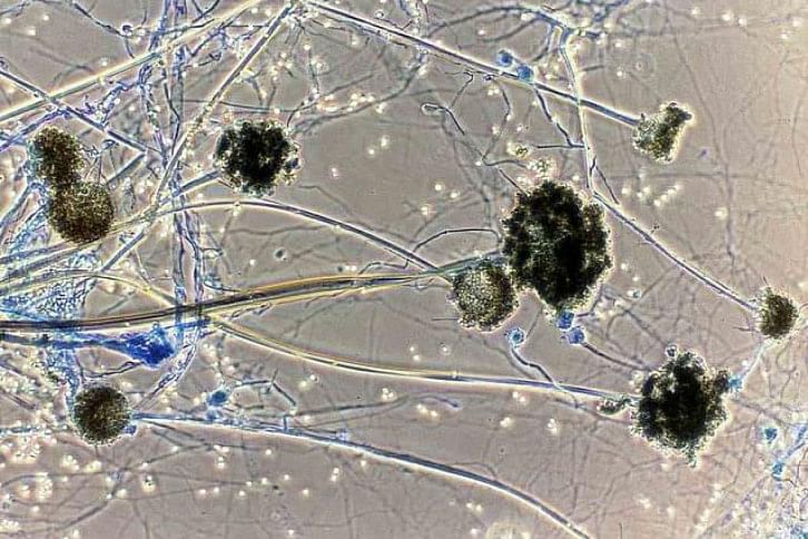 Black Fungus.jpg Black Fungus.jpg