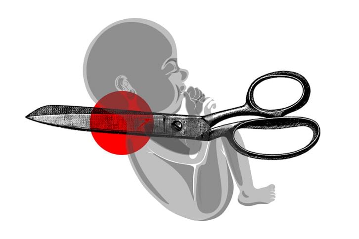 Scissor Scissor