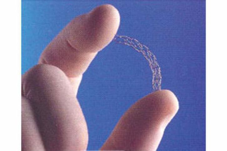 Stent Stent