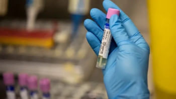 মাঙ্কিপক্স