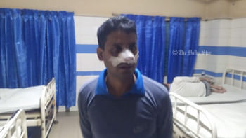 ২ জঙ্গি ছিনতাই: আহত পুলিশ সদস্য চোখে দেখতে পাচ্ছেন ২ জঙ্গি ছিনতাই: আহত পুলিশ সদস্য চোখে দেখতে পাচ্ছেন