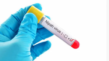 নিপাহ ভাইরাস