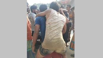 মিয়ানমার থেকে গুলিবিদ্ধ ১০ জন পালিয়ে বাংলাদেশে মিয়ানমার থেকে গুলিবিদ্ধ ১০ জন পালিয়ে বাংলাদেশে