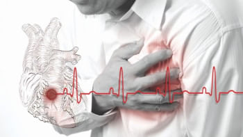 হার্ট অ্যাটাক