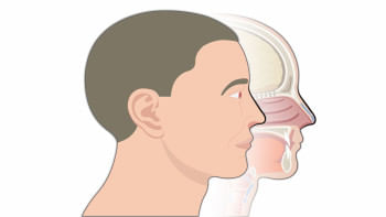 নাকের পলিপ