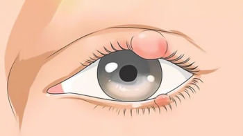 চোখে অঞ্জনি