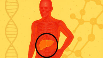 ফ্যাটি লিভার