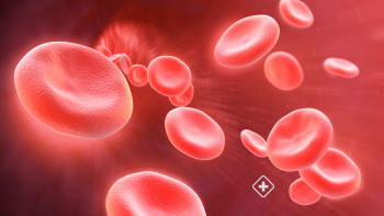 অ্যাকিউট অ্যানিমিয়া