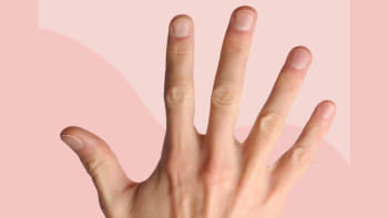 হাতের নখ নরম হয় কেন, করণীয় কী