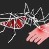 dengue dengue