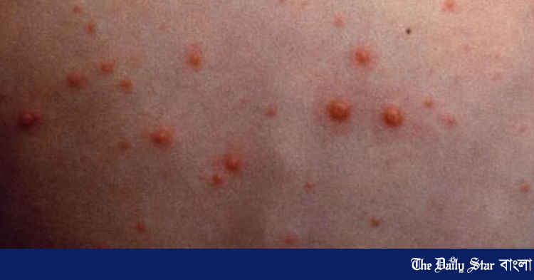 Ayollar erotik kurashi