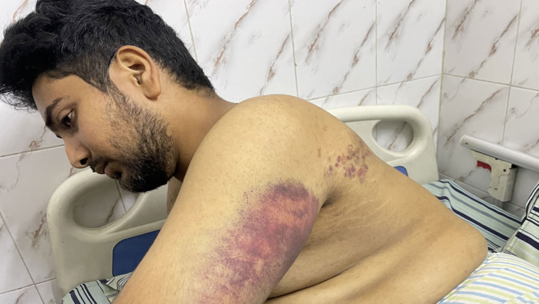 Jamoat hojatxonasida anal jinsiy aloqa