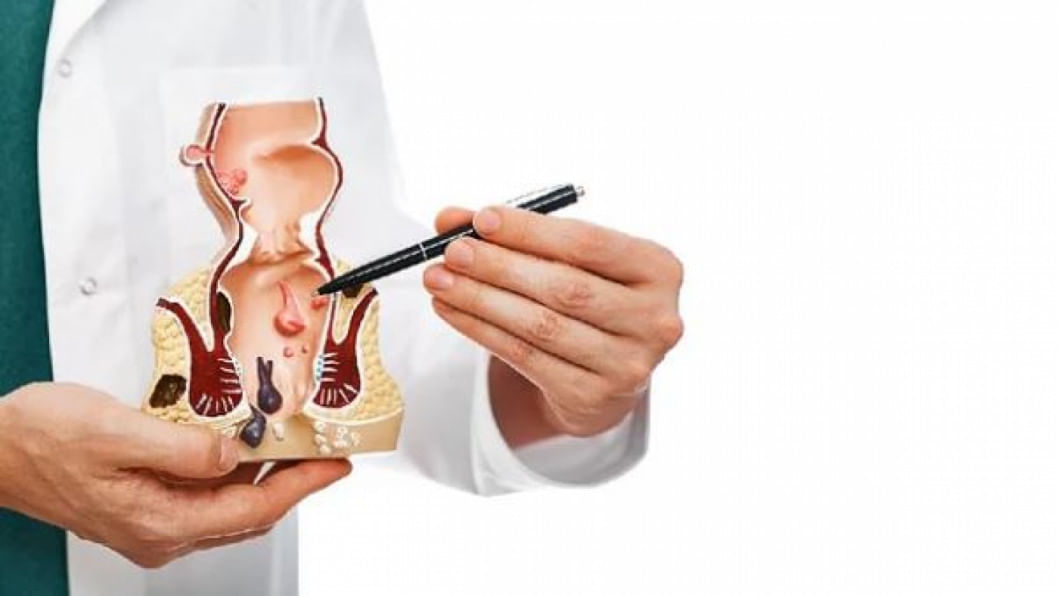 Kasting porno Samara